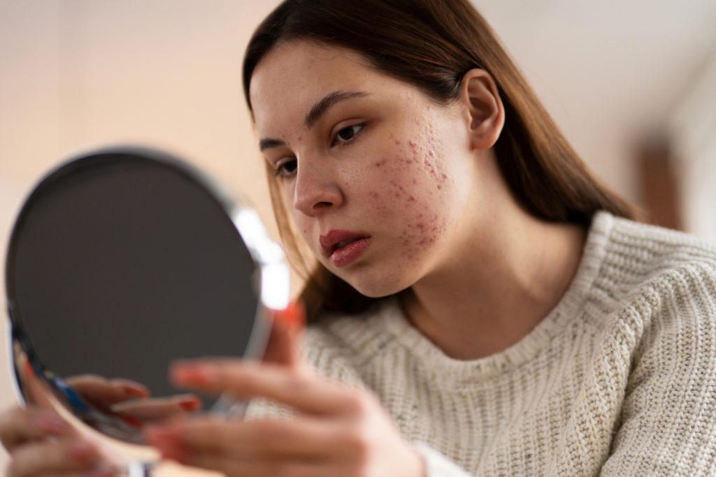 Woman with skin rashes looking in mirror showing peptide side effects and safety concerns in 2025.